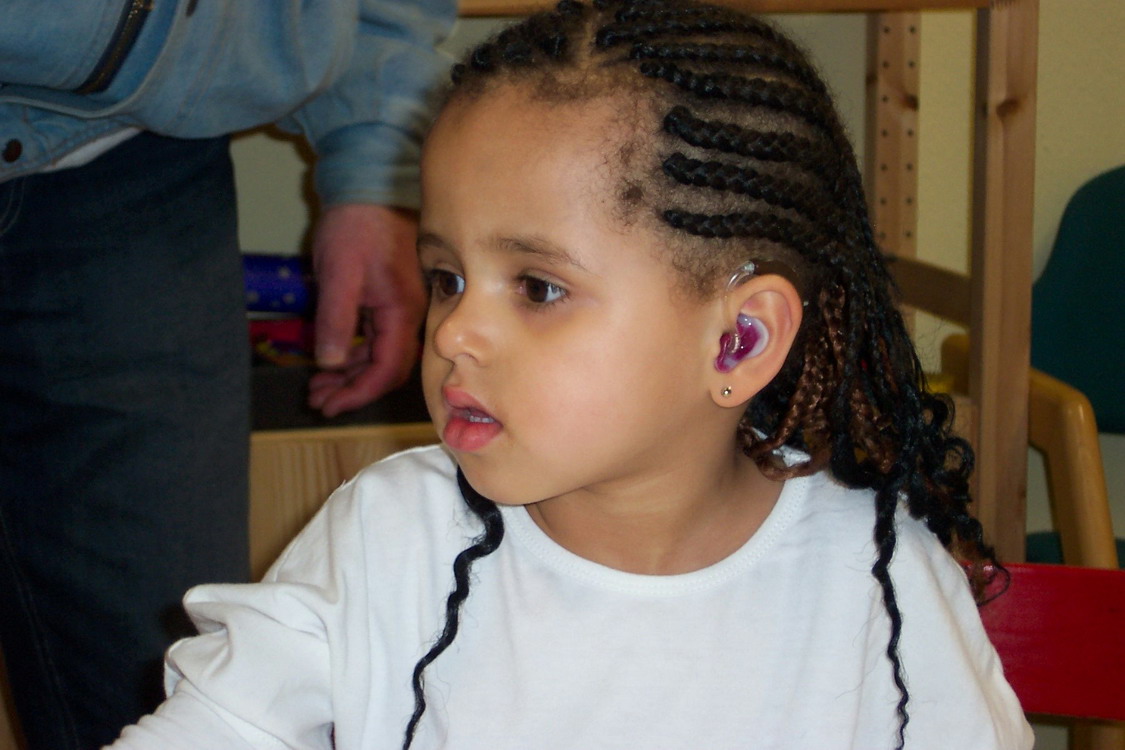 Ein Kind mit lilafarbigen Hörgerät und verträumten Blick.